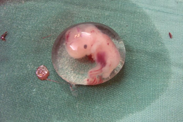 Human_Embryo