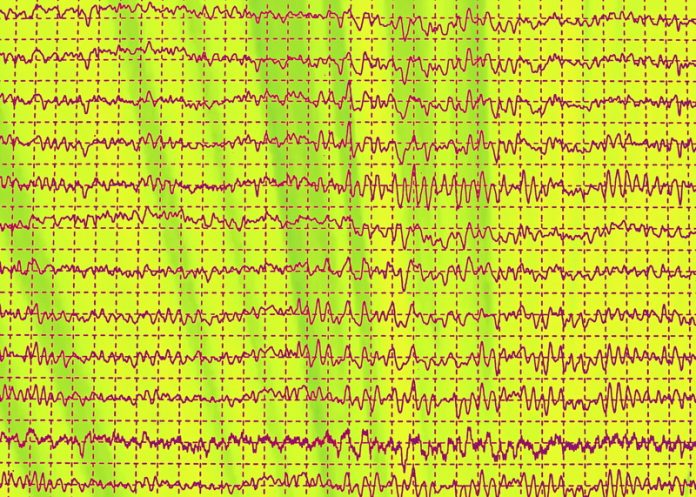 Epilepsie hersengolven