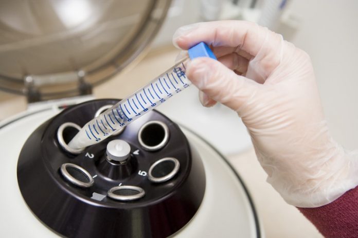 bevruchting In vitro maturation