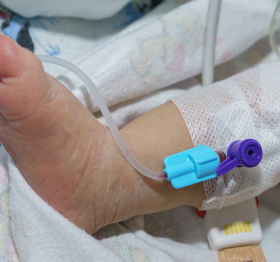 Ontwikkeling baby’s na verblijf op intensive care blijven volgen