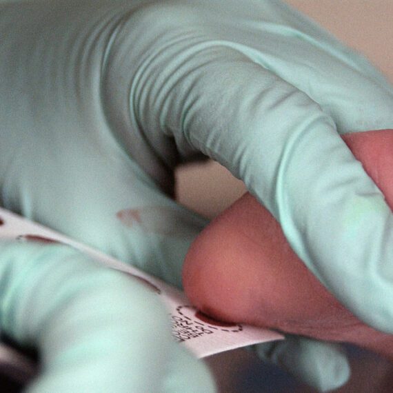 Staatssecretaris wil pasgeboren baby’s laten testen op spinale musculaire atrofie