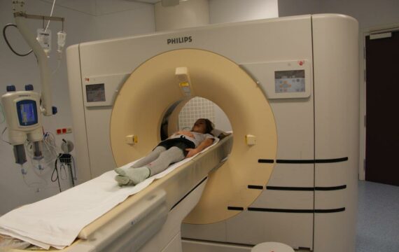 CT-scan van kinderhoofd na huis-tuin-en-keukenongeluk vaak onnodig