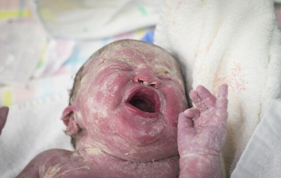 Nieuwe kennis over hersenontwikkeling baby’s biedt zicht op verbeteren zorg aan prematuren