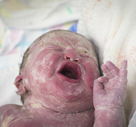 Nieuwe kennis over hersenontwikkeling baby’s biedt zicht op verbeteren zorg aan prematuren