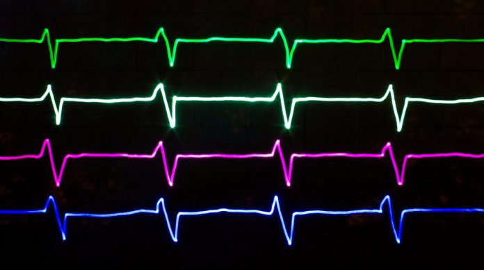 Hartritmevariabiliteit