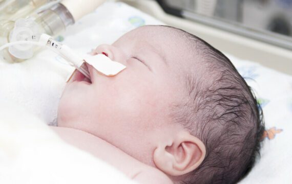 Beter medicijngebruik winst voor behandeling baby met zuurstofgebrek