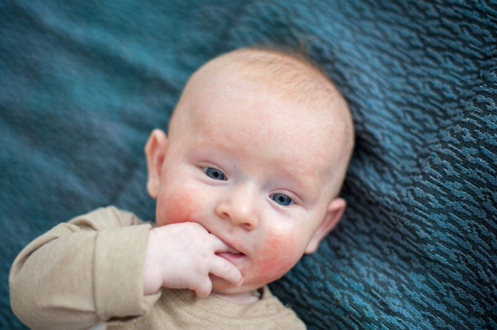 Allergie canstockphoto55835499