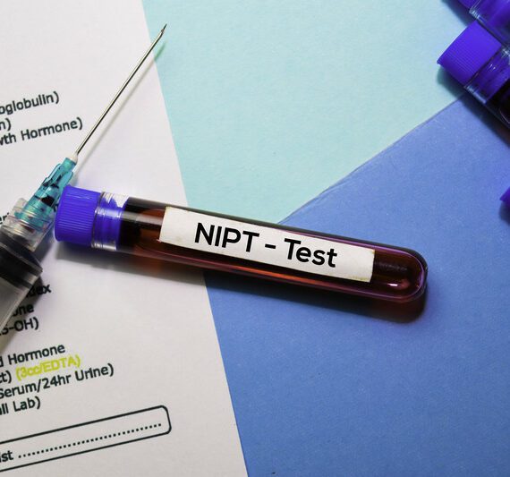 Rapporteer niet automatisch nevenbevindingen bij niet-invasieve prenatale test (NIPT)