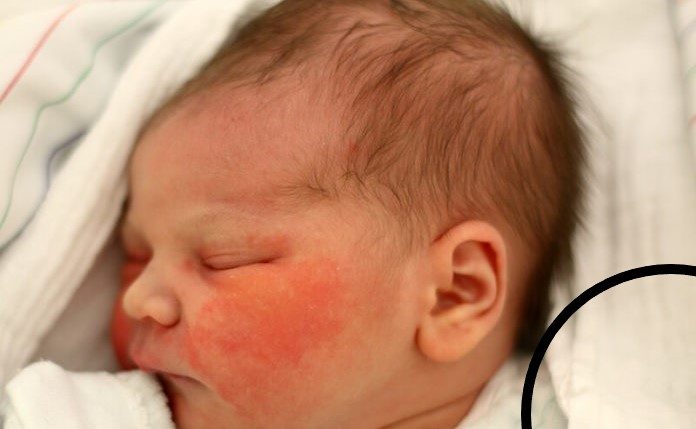 Baby 1