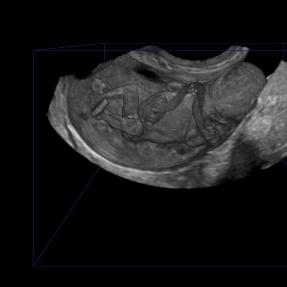 Hologrammen embryo’s geven inzicht in leefstijl moeder