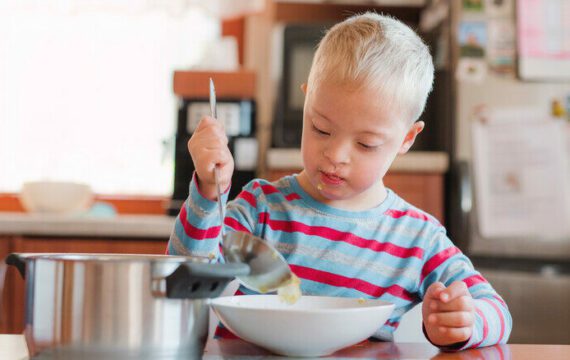 Cerebrale parese werkt eet- en drinkproblemen in de hand