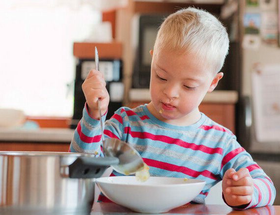 Cerebrale parese werkt eet- en drinkproblemen in de hand