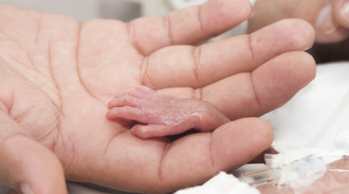 Prematuur canstockphoto16303534