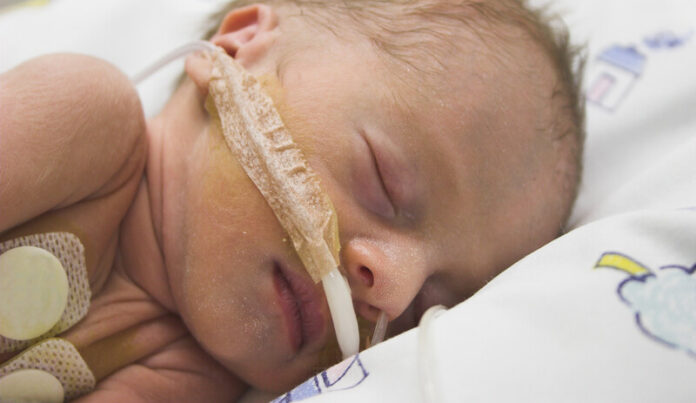 Prematuur canstockphoto648935