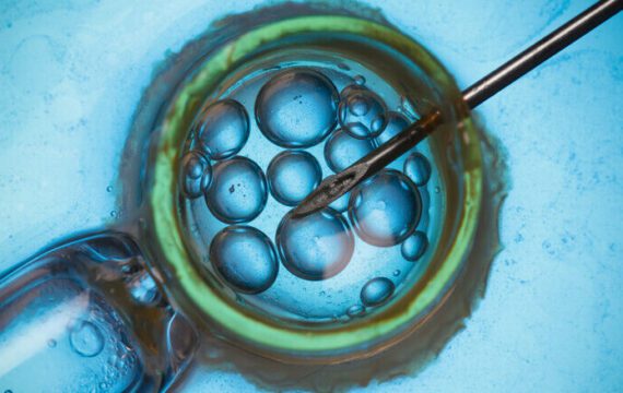 IVF nu mogelijk zonder hormoonbehandeling