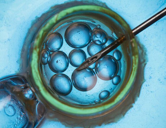 IVF nu mogelijk zonder hormoonbehandeling