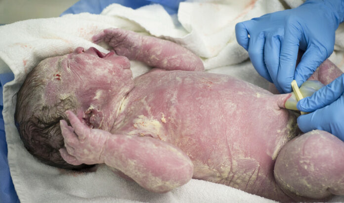 Afnavelen baby canstockphoto12394811 (1)