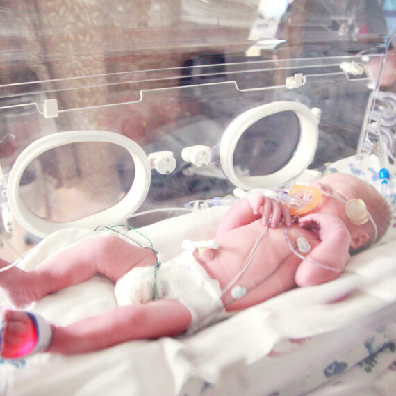 Lancet-rapport: innovatie in de neonatologie blijft ernstig achter